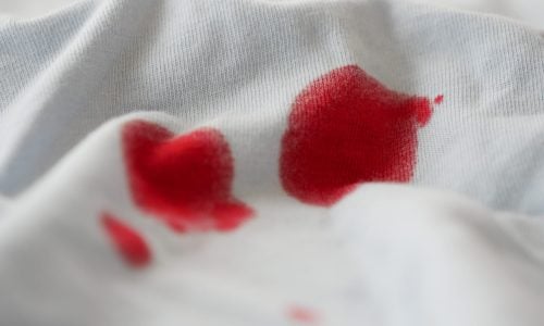 blood stains on a white shirt